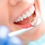 Bọc răng sứ thẩm mỹ là gì? Có hiệu quả không?