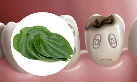cách chữa đau răng