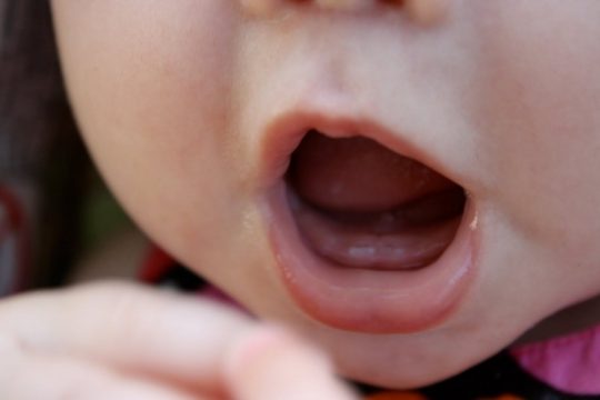 Nguyên nhân vì sao trẻ chậm mọc răng
