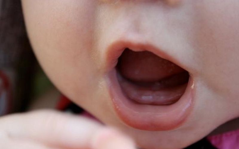 Trẻ mọc răng là quá trình phát triển bình thường do các mầm răng nhú ra khỏi lợi gây đau nhức ở trẻ.