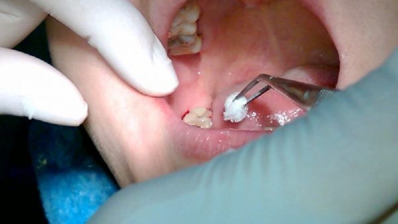 Tại phòng khám nha khoa, mọi nguyên nhân gây đau răng đều được bác sĩ khắc phục triệt để