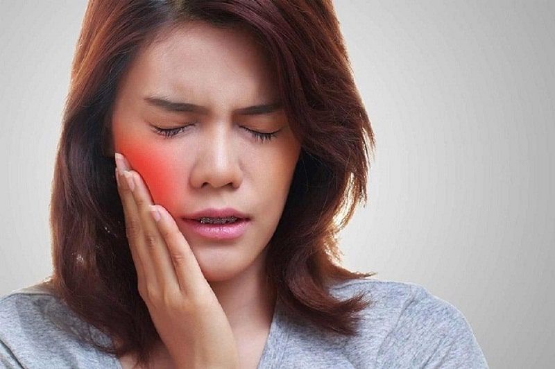 Đau răng bị sưng má có thể khởi phát do sâu răng