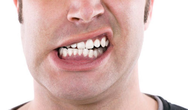Nghiến răng là một trong những thói quen xấu ảnh hưởng tới răng hàm