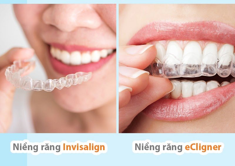 Ecligner và Invisalign đều là loại niềng răng không sử dụng mắc cài