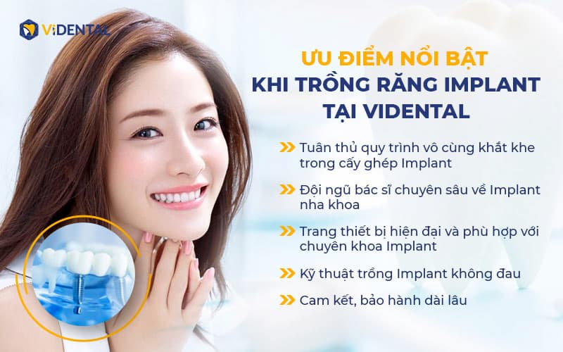 Một số ưu điểm khi trồng răng Implant tại Nha khoa Vidental