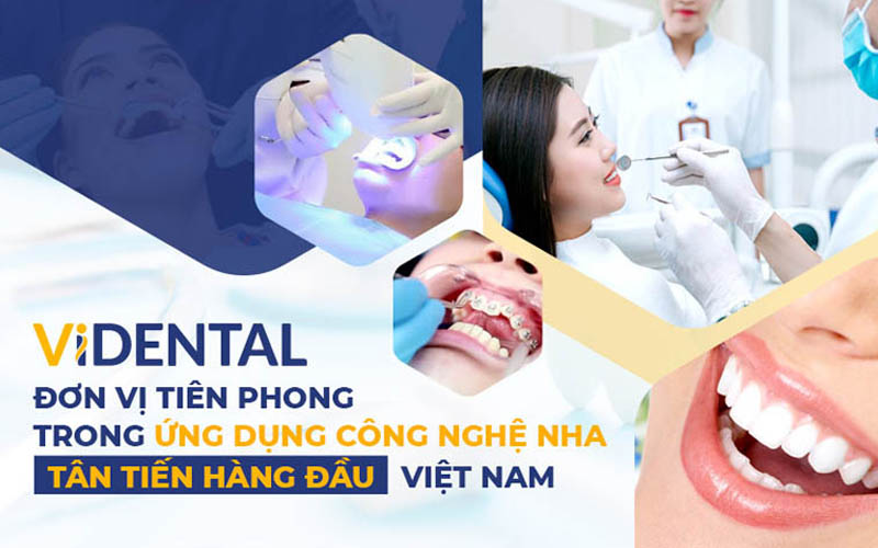 ViDental - Địa chỉ chăm sóc răng miệng uy tín và chất lượng
