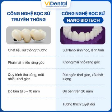 Công nghệ răng sứ sinh học mang đến những ưu điểm vượt trội