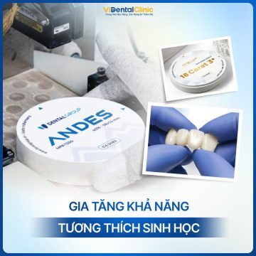 Răng sứ Andes - Thương hiệu răng sứ an toàn và lành tính